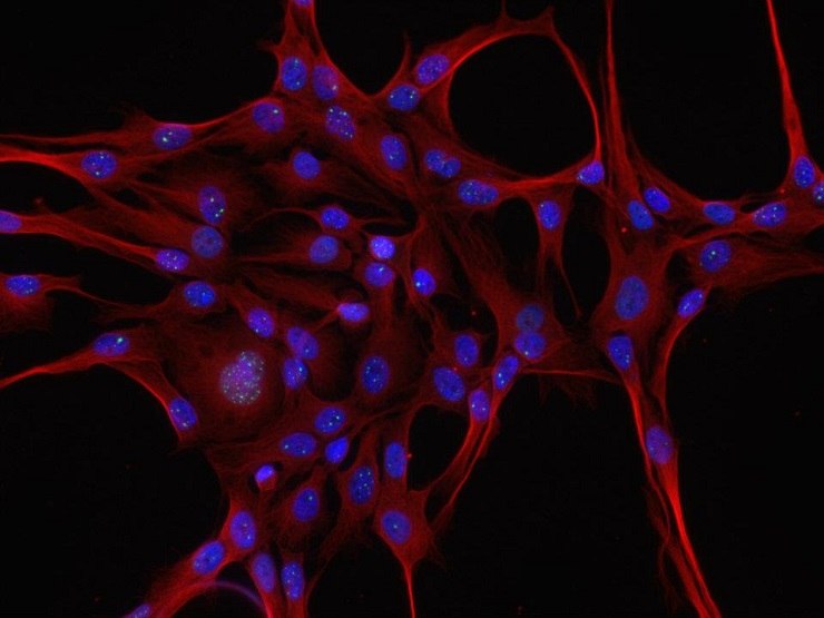 Tripla colorazione di un neurone